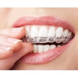 FGM Whiteness Perfect %16 Ev Tipi Beyazlatma Tekli Şırınga FGM Whiteness Perfect %16 Ev Tipi Beyazlatma Tekli Şırınga